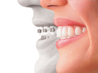Granger Dentistry | Oral Exams, Extractions and Implant Restorations