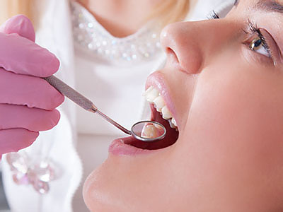 Granger Dentistry | Oral Cancer Screening, Juvederm reg  and Dental Fillings